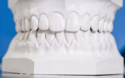 How Orthodontics Benefit From Digital Impressions