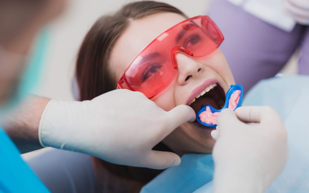 Foods That Naturally Contain Fluoride