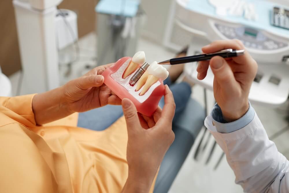 Embracing the Future of Smiles: The Superiority of Dental Implants