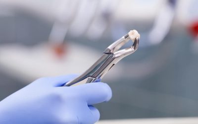 Navigating Your Tooth Extraction Journey with Dr. Steven Fidone