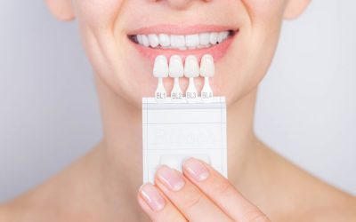 Navigating the Crossroads of Aesthetic Dentistry: Crowns vs. Veneers