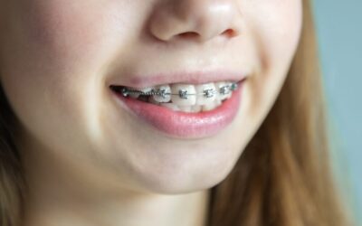 Myths and Misconceptions About Orthodontic Treatment