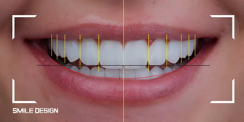 Myths and Misconceptions About Orthodontic Treatment