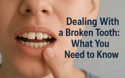 Dealing With a Broken Tooth: What You Need to Know