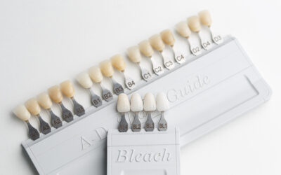 Understanding the Different Types of Dental Veneers