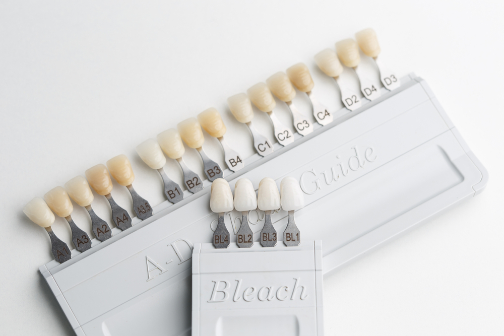 Understanding the Different Types of Dental Veneers