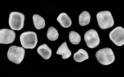 The Process of Getting Dental Crowns