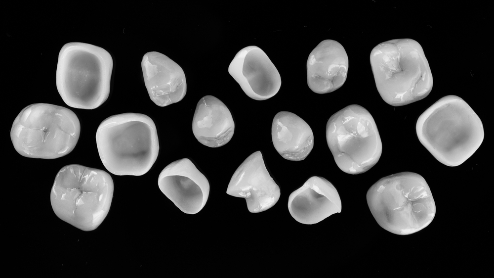 The Process of Getting Dental Crowns