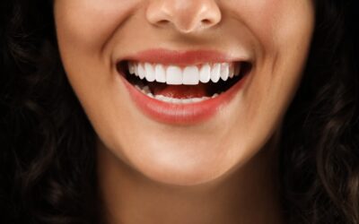 Teeth Whitening: Is It Right for You?