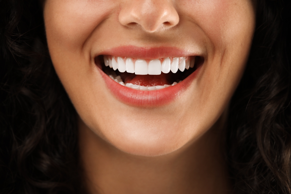 Teeth Whitening: Is It Right for You?