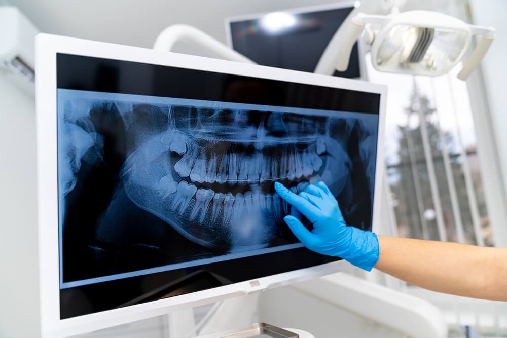 Technology’s Impact on Dental Procedures and Care